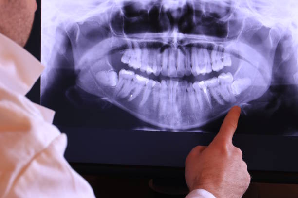 Best Emergency Gum Treatment in Camilla, GA